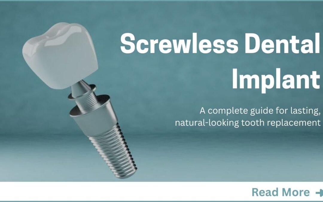 What Are Screwless Dental Implants?