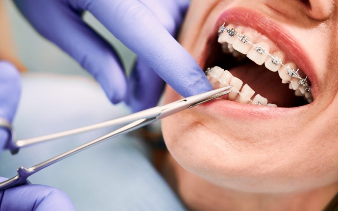 A Complete Guide to Orthodontic Treatment
