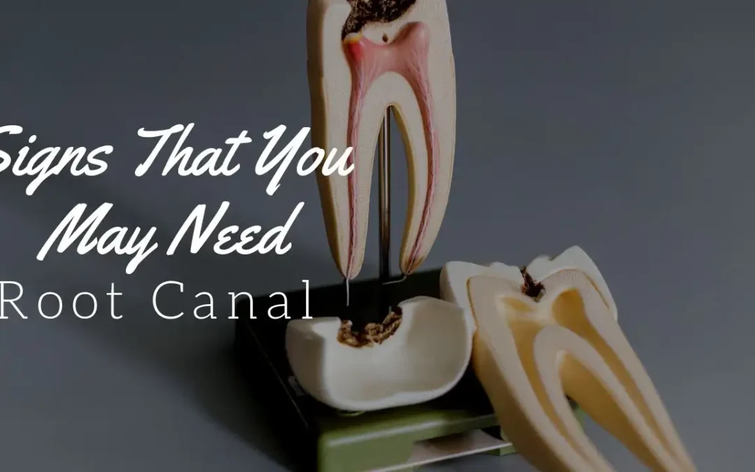 Early Warning Signs You Need a Root Canal Treatment