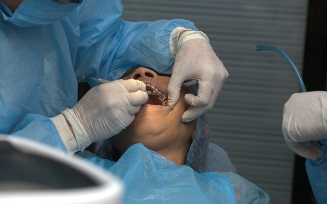 Common Signs of Infection After Wisdom Teeth Removal, Even on Antibiotics